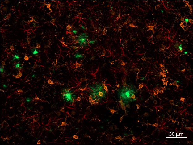 Alzheimer rat cortex